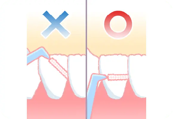 イメージ:歯間ブラシの角度