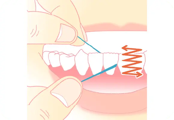 イメージ:デンタルフロス